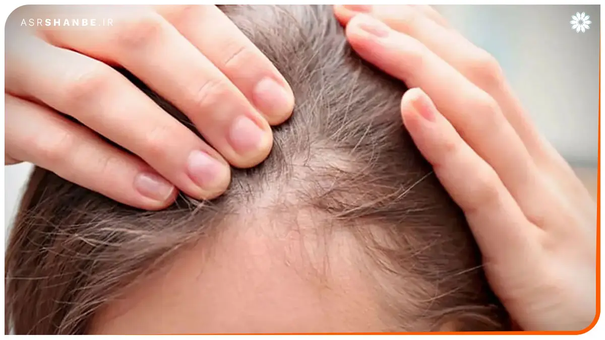 زینو بیوتی 01